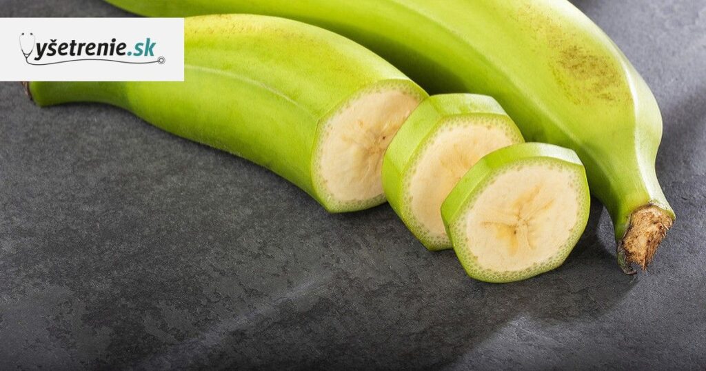 15 loại thức ăn (Prebiotic) tốt nhất cho lợi khuẩn đường ruột