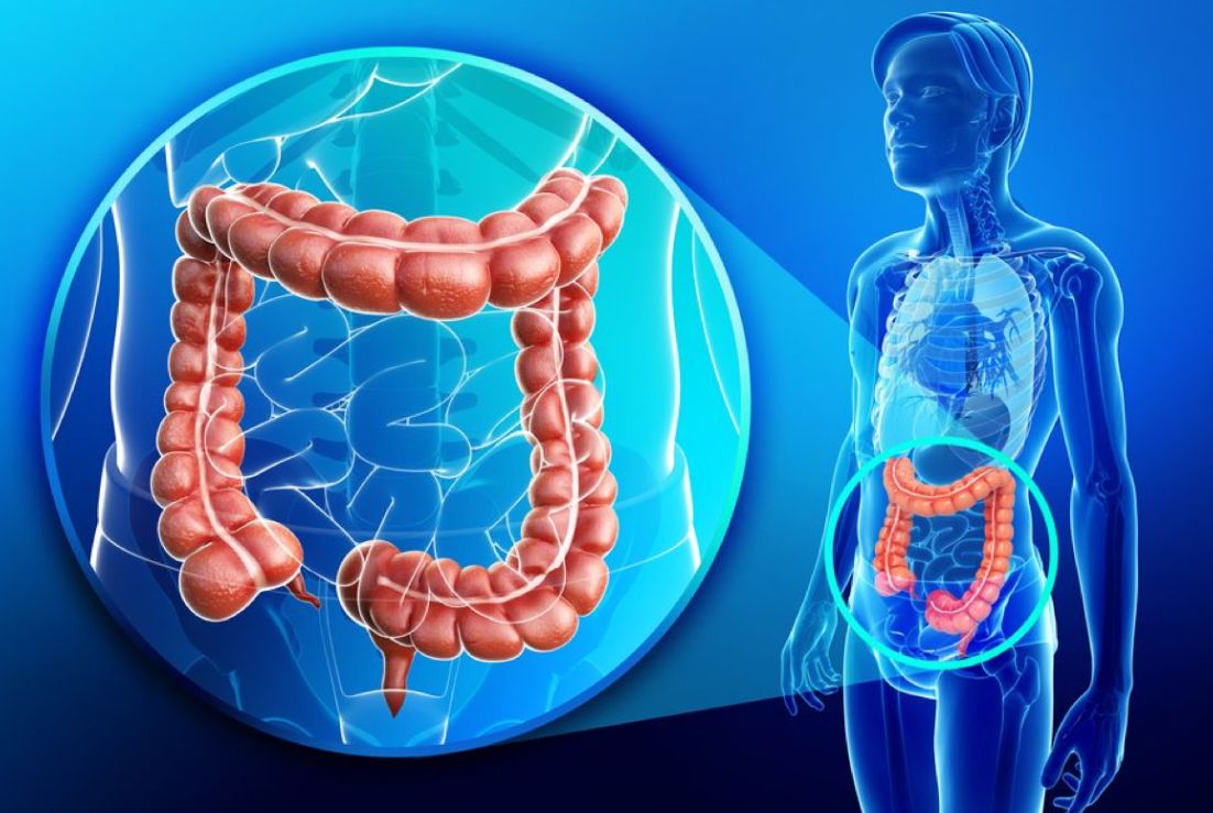 Hội chứng ruột kích thích có thể dùng tinh bột kháng không